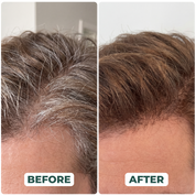 Gray Hair Reversal Drops | Restore Natural Hair Color | Root Activator