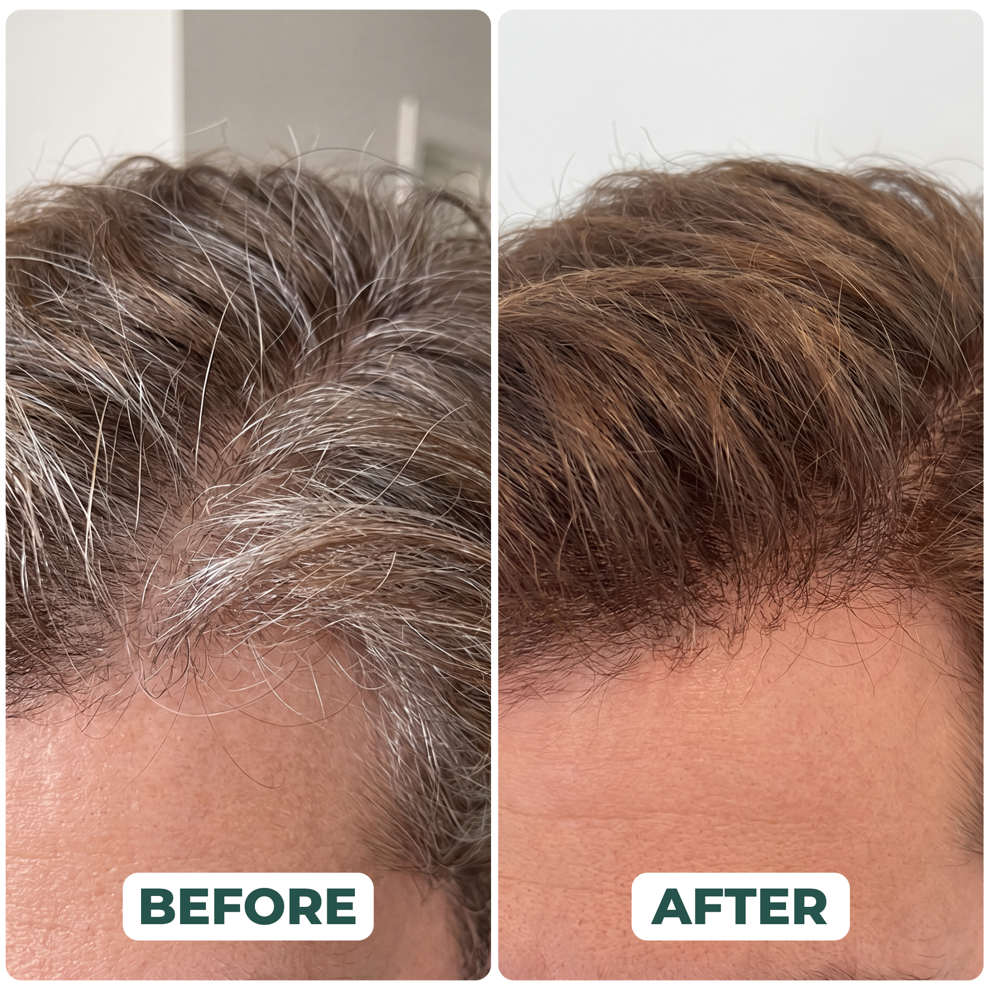 Gray Hair Reversal Drops | Restore Natural Hair Color | Root Activator