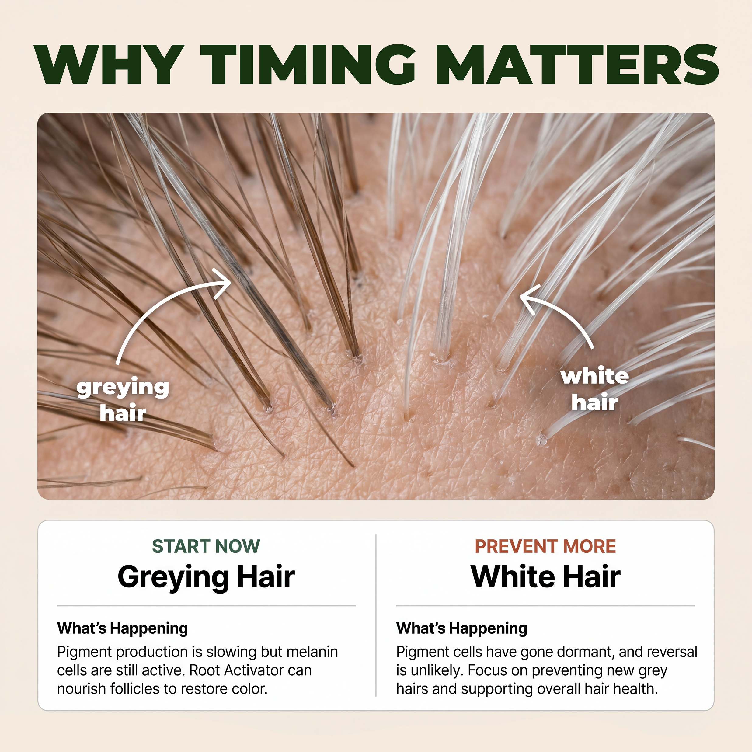 Gray Hair Reversal Drops | Restore Natural Hair Color | Root Activator